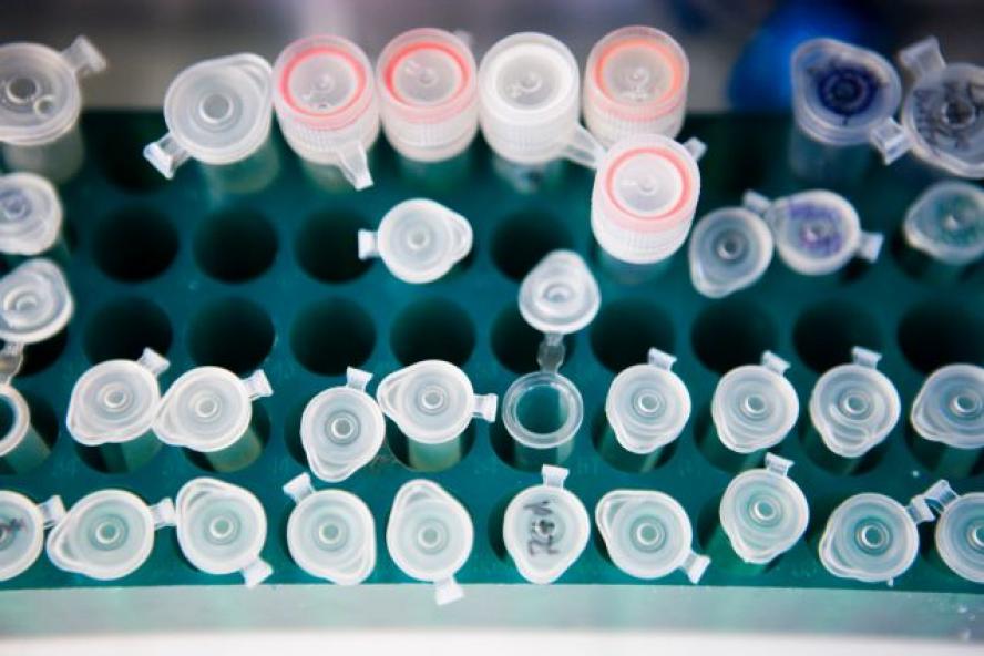 Test tubes in lab.