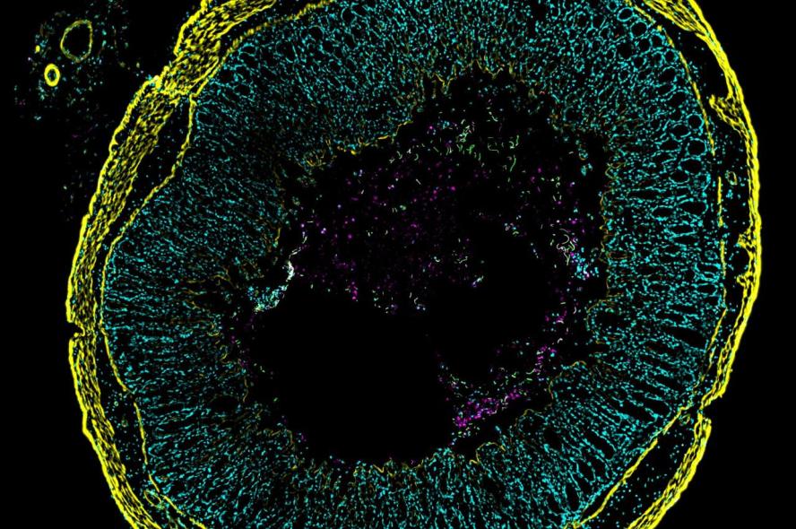 A colorful image shows a round cross-section of inflamed gut tissue. Tiny green squiggles represent C. diff cells where toxin genes are turned on throughout the tissue layers colored yellow or cyan. The magenta highlights the subset of C. diff that do not express the toxin genes.