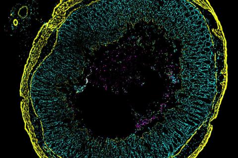 A colorful image shows a round cross-section of inflamed gut tissue. Tiny green squiggles represent C. diff cells where toxin genes are turned on throughout the tissue layers colored yellow or cyan. The magenta highlights the subset of C. diff that do not express the toxin genes.